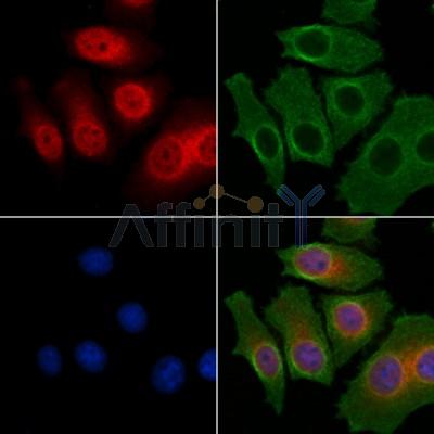 NF-kB p65 Antibody - AF5006 staining HepG2 cells by IF/ICC.
