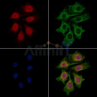 CNOT8 Antibody - DF12903 staining HepG2 cells by IF/ICC.