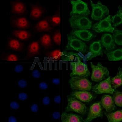 ECD Antibody - DF12968 staining HepG2 cells by IF/ICC.