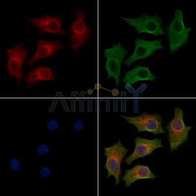 FOXRED1 Antibody - DF13021 staining HepG2 cells by IF/ICC.