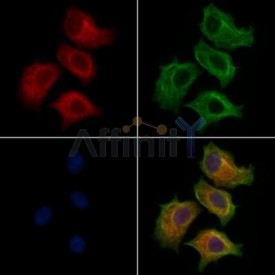 GLTP Antibody - DF13042 staining HepG2 cells by IF/ICC.