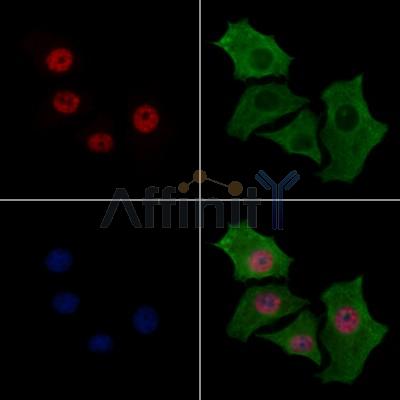 HNRNPH3 Antibody - DF13064 staining HepG2 cells by IF/ICC.