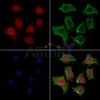 HNRNPR Antibody - DF13065 staining HepG2 cells by IF/ICC.