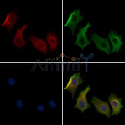 IFT122 Antibody - DF13082 staining HepG2 cells by IF/ICC.