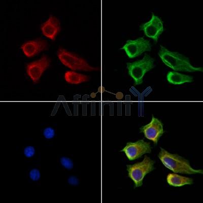 LOH12CR1 Antibody - DF13131 staining HepG2 cells by IF/ICC.