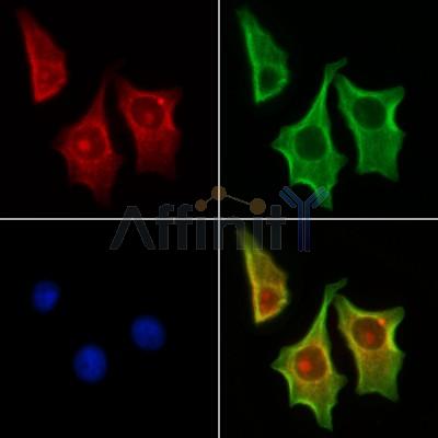 MAP1S Antibody - DF13137 staining HepG2 cells by IF/ICC.