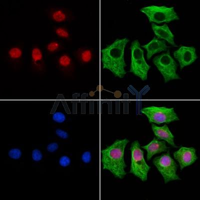 MED10 Antibody - DF13141 staining HepG2 cells by IF/ICC.