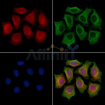 MIPEP Antibody - DF13151 staining HepG2 cells by IF/ICC.