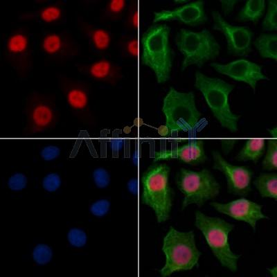 MYEOV Antibody - DF13163 staining HepG2 cells by IF/ICC.
