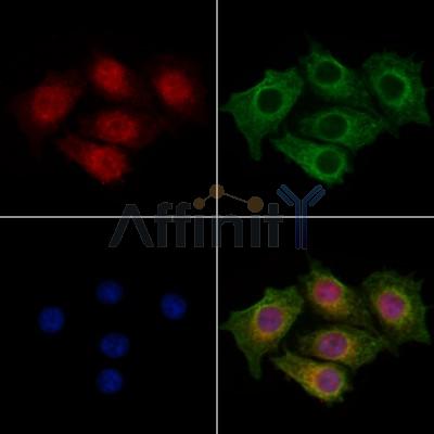 CENPB Antibody - DF13261 staining HepG2 cells by IF/ICC.