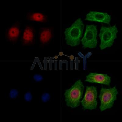 LAP2 alpha Antibody - DF13264 staining HepG2 cells by IF/ICC.