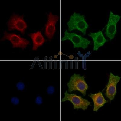 Activin Receptor Type IA Antibody - DF13370 staining HepG2 cells by IF/ICC.