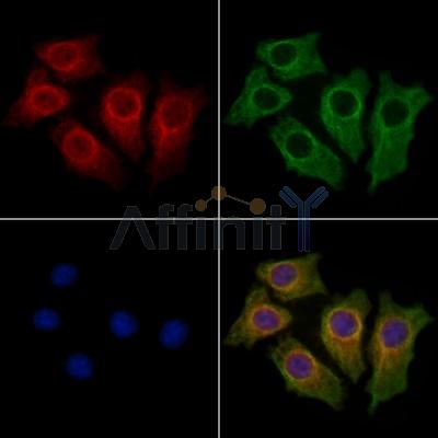 Trichohyalin Antibody - DF13392 staining HepG2 cells by IF/ICC.