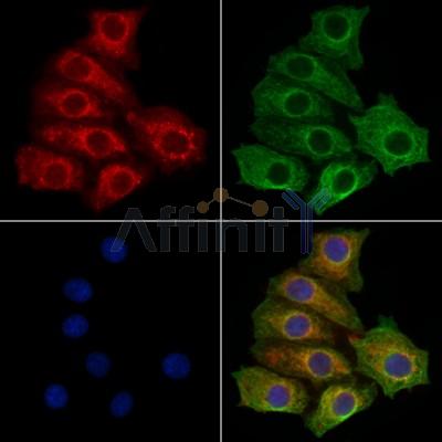 Steroid sulfatase Antibody - DF13557 staining HepG2 cells by IF/ICC.