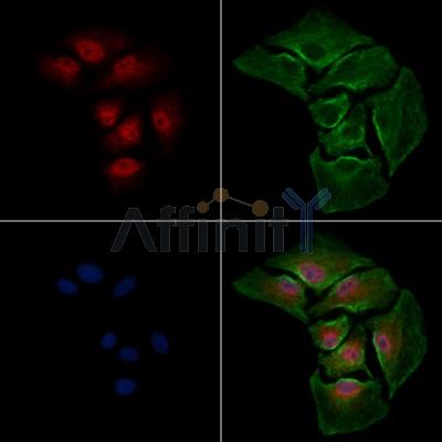 ADCY10 Antibody - DF13600 staining A549 cells by IF/ICC.