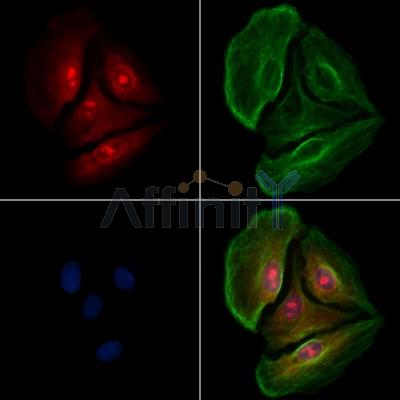 FLIP Antibody - DF13733 staining A549 cells by IF/ICC.