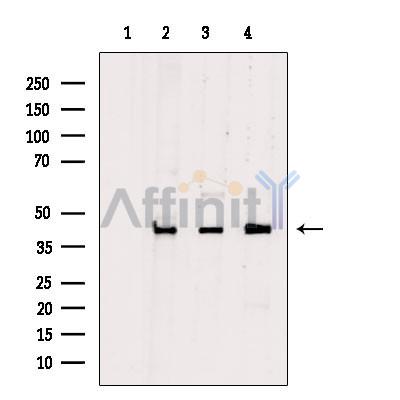 PDHA2 Antibody - Western blot analysis of extracts from various samples, using PDHA2 Antibody.