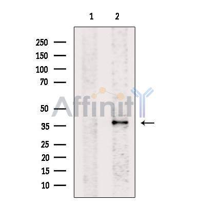 EpCAM Antibody - Western blot analysis of extracts from lovo, using TACSTD1  Antibody.