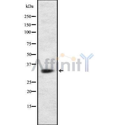 BNIP3L Antibody - Western blot analysis of BNIP3L using LOVO whole cell lysates.