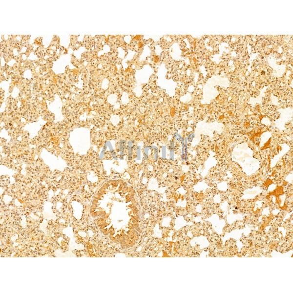 ERK1/2 Antibody - AF0155 at 1/100 staining Rat lung tissue by IHC-P.