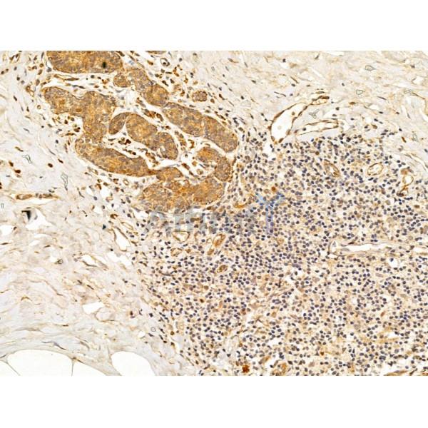 ERK1/2 Antibody - AF0155 at 1/100 staining Human normal tissues adjacent to mammary cancer by IHC-P.