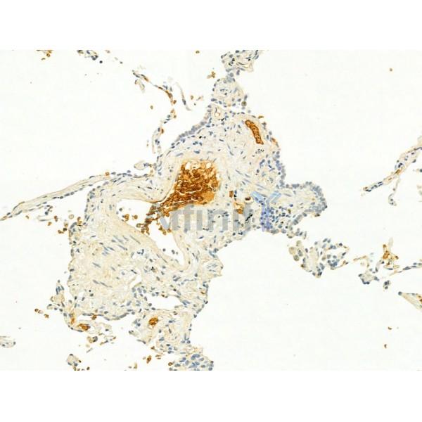 GLUT1 Antibody - AF0173 at 1/100 staining Human normal tissues adjacent to lung cancer by IHC-P.