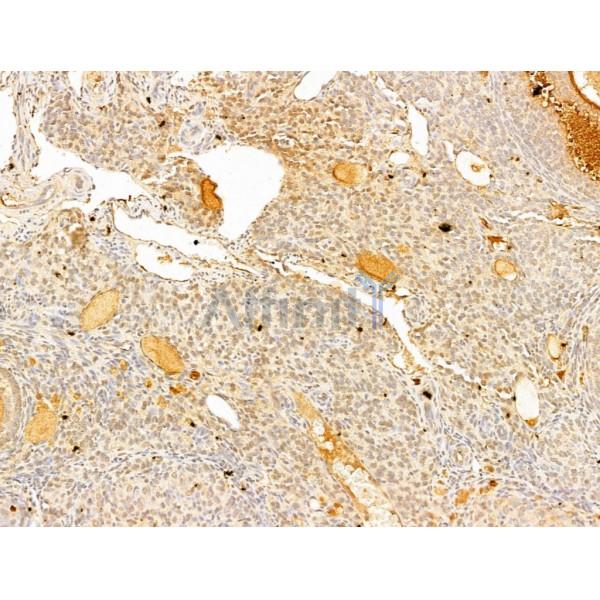Phospho-IKK beta (Tyr188) Antibody - AF3009 at 1/100 staining Mouse ovary tissue by IHC-P.