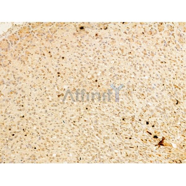 Phospho-IKK beta (Tyr188) Antibody - AF3009 at 1/100 staining Mouse stomach tissue by IHC-P.