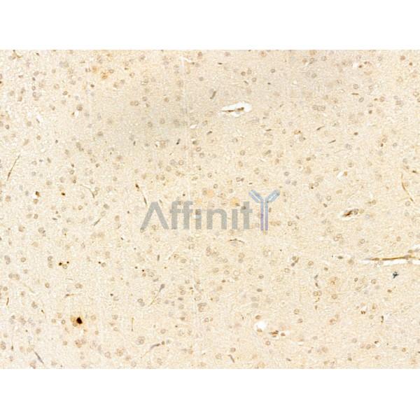 Phospho-IKK beta (Tyr188) Antibody - AF3009 at 1/100 staining Rat brain tissue by IHC-P.