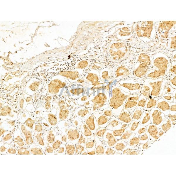 Phospho-IKK beta (Tyr188) Antibody - AF3009 at 1/100 staining Human normal tissues adjacent to gastric cancer by IHC-P.