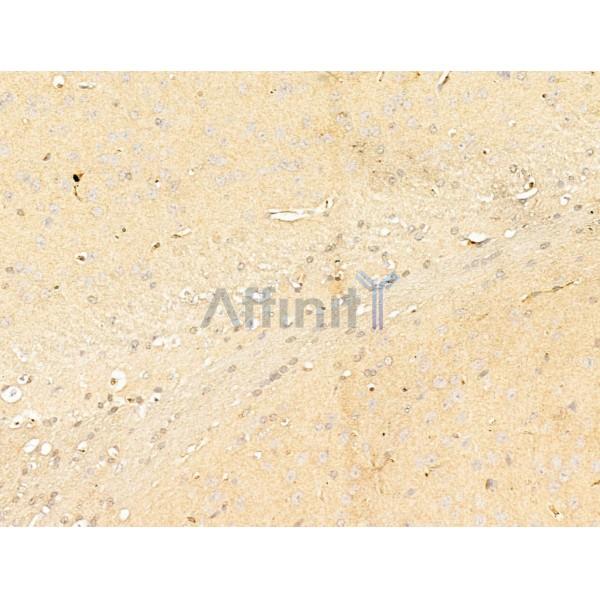 Phospho-IKK beta (Tyr199) Antibody - AF3010 at 1/100 staining Mouse brain tissue by IHC-P.