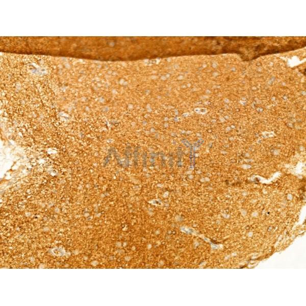 Phospho-ROCK2 (Tyr722) Antibody - AF3028 at 1/100 staining Rat brain tissue by IHC-P.