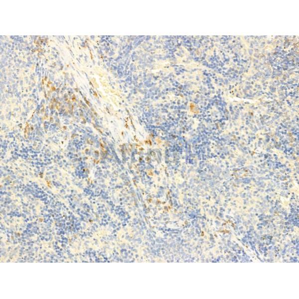 Phospho-ROCK2 (Tyr722) Antibody - AF3028 at 1/100 staining Rat spleen tissue by IHC-P.