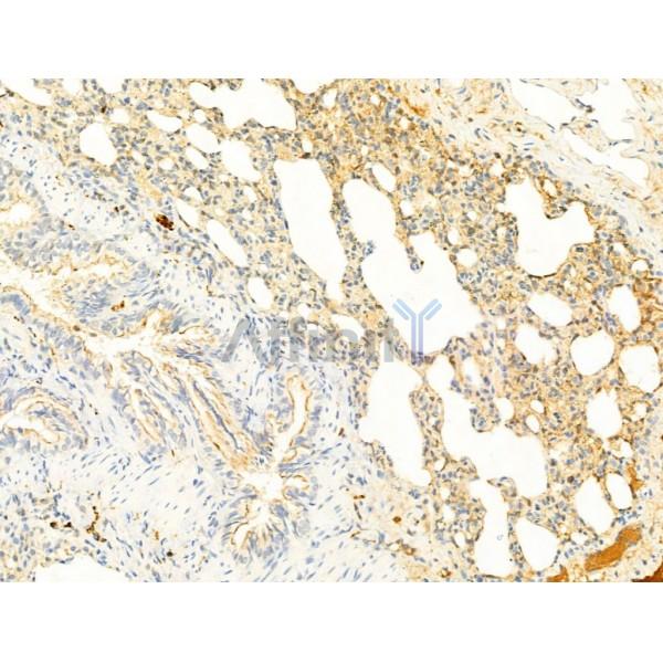 Phospho-ROCK2 (Tyr722) Antibody - AF3028 at 1/100 staining Rat lung tissue by IHC-P.