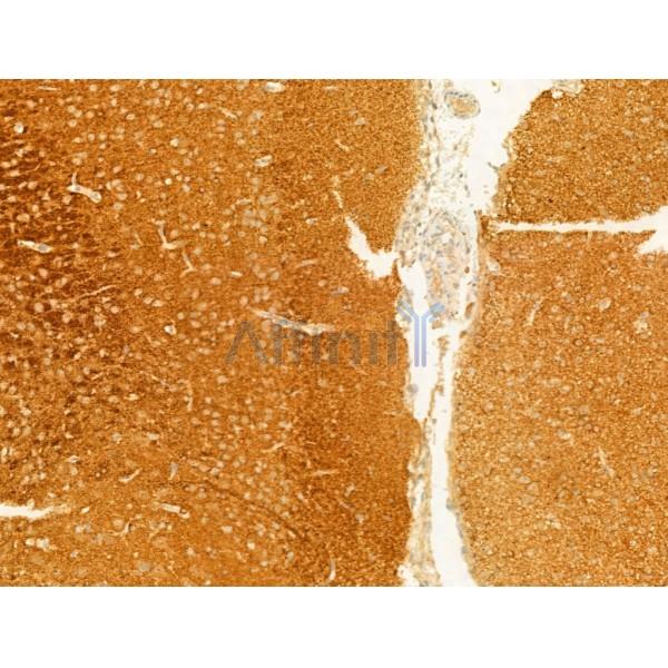 Phospho-Tau (Ser396) Antibody - AF3148 at 1/100 staining Rat brain tissue by IHC-P.