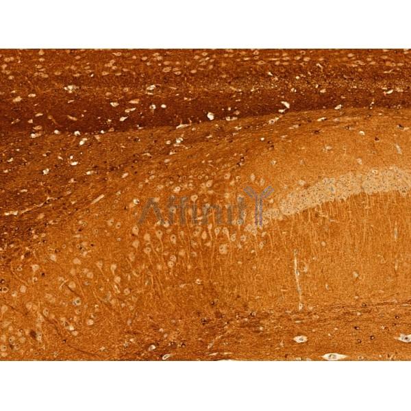 Phospho-Tau (Ser396) Antibody - AF3148 at 1/100 staining Mouse brain tissue by IHC-P.