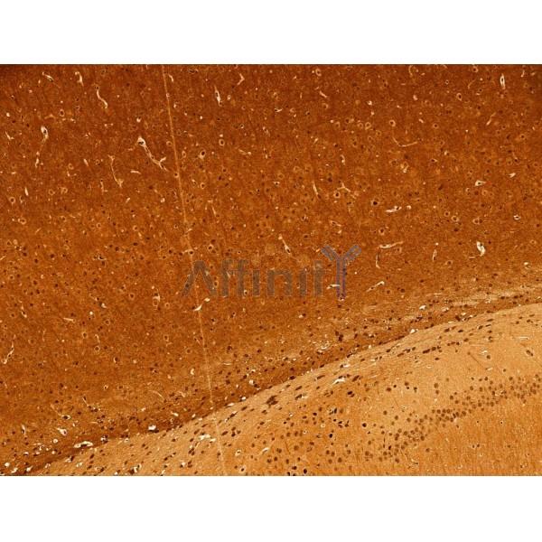 Phospho-Tau (Thr205)[Thr522] Antibody - AF3150 at 1/100 staining Mouse brain tissue by IHC-P.