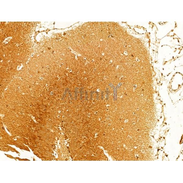 Phospho-Tau (Thr205)[Thr522] Antibody - AF3150 at 1/100 staining Rat brain tissue by IHC-P.