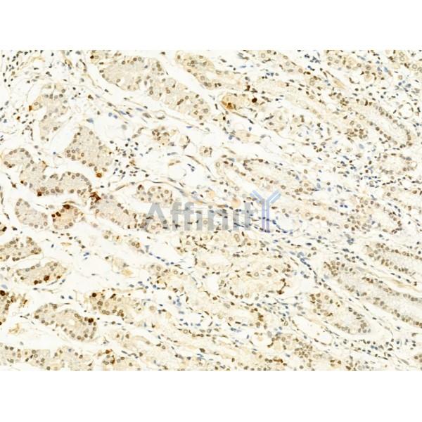 Phospho-mTOR (Ser2448) Antibody - AF3308 at 1/100 staining Human normal tissues adjacent to gastric cancer by IHC-P.