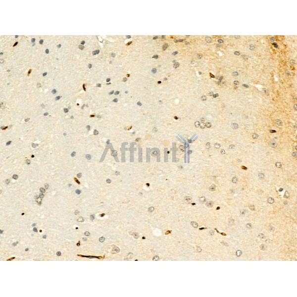 Phospho-mTOR (Ser2448) Antibody - AF3308 at 1/100 staining Mouse brain tissue by IHC-P.