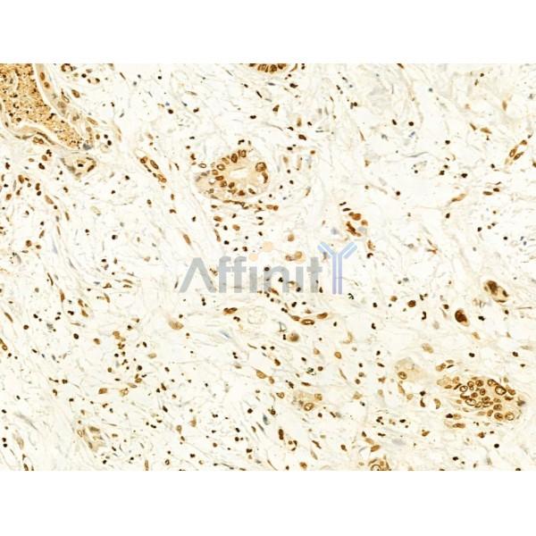 Phospho-mTOR (Ser2448) Antibody - AF3308 at 1/100 staining Human normal tissues adjacent to pancreatic cancer by IHC-P.