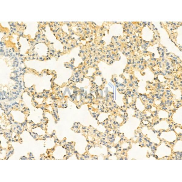 Phospho-mTOR (Ser2448) Antibody - AF3308 at 1/100 staining Rat lung tissue by IHC-P.