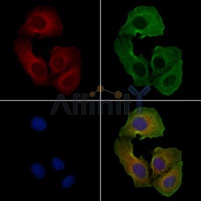 Phospho-JNK1/2/3 (Thr183+Tyr185) Antibody - AF3318 staining H2O2 treated Hela cells by IF/ICC.