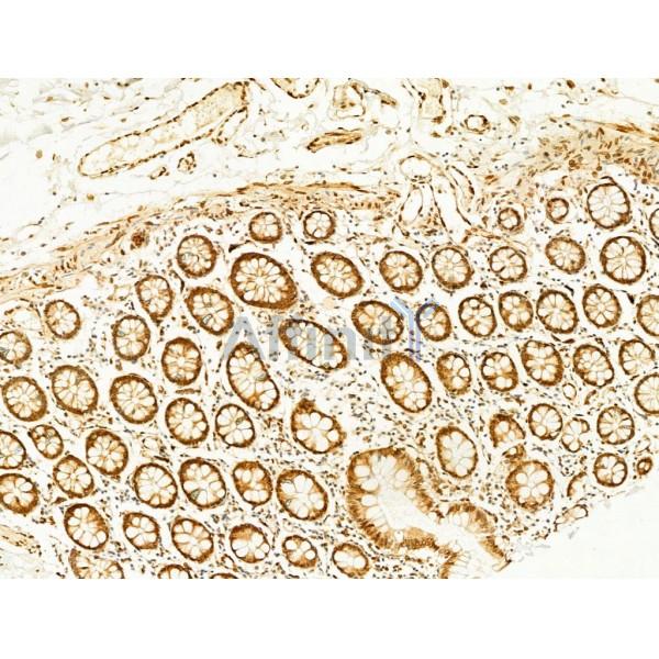 Phospho-JNK1/2/3 (Thr183+Tyr185) Antibody - AF3318 at 1/100 staining Human normal tissues adjacent to colorectal cancer by IHC-P.