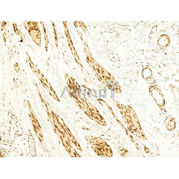 Phospho-JNK1/2/3 (Thr183+Tyr185) Antibody - AF3318 at 1/100 staining Human normal tissues adjacent to esophageal cancer by IHC-P.
