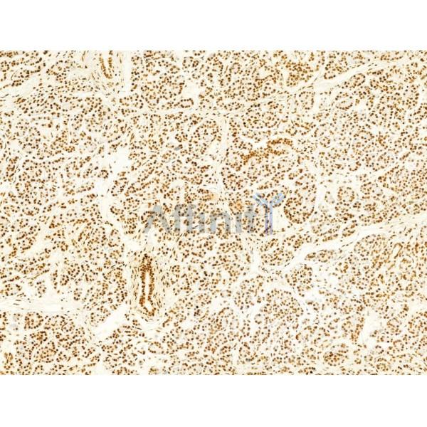 Phospho-FAK (Tyr397) Antibody - AF3398 at 1/100 staining Human normal tissues adjacent to pancreatic cancer by IHC-P.