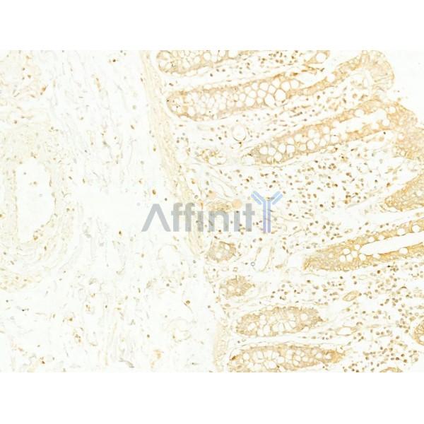 Twist1 Antibody - AF4009 at 1/100 staining Human normal tissues adjacent to colorectal cancer by IHC-P.