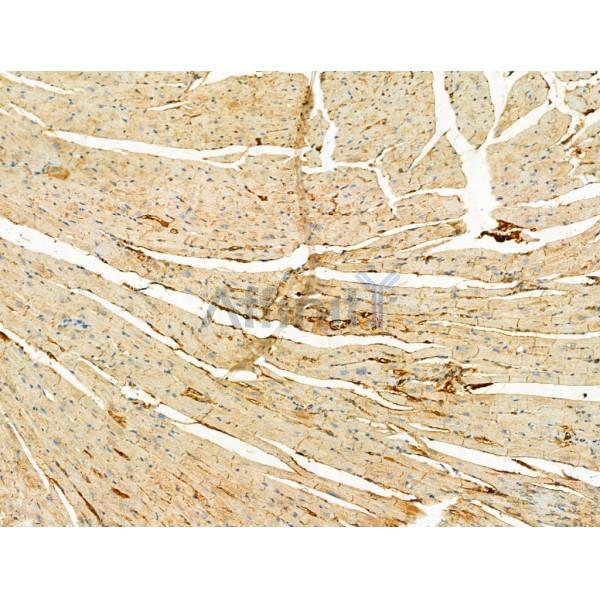 Phospho-ULK1 (Ser757)[Ser758] Antibody - AF4387 at 1/100 staining Mouse heart tissue by IHC-P.