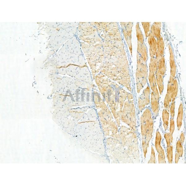 Phospho-ULK1 (Ser757)[Ser758] Antibody - AF4387 at 1/100 staining Rat skin tissue by IHC-P.
