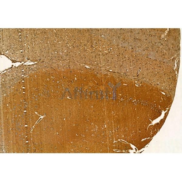 MMP9 Antibody - AF5228 at 1/100 staining Rat brain tissue by IHC-P.